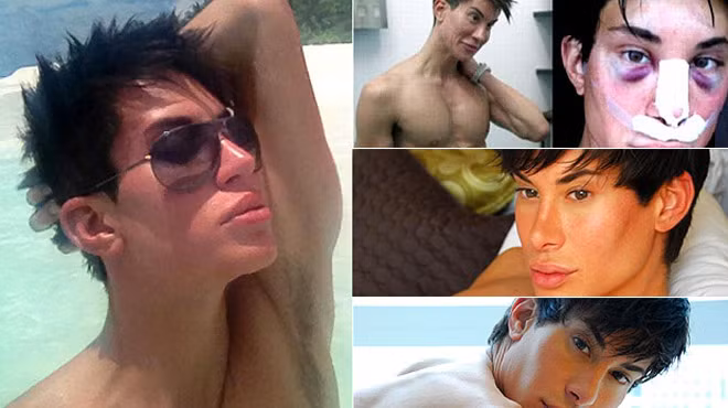 Anh chàng búp bê Justin Jedlica đã phải chịu những đau đớn về thể xác để có ngoại hình búp bê như ý muốn.