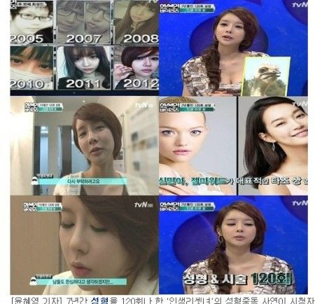 Quá trình phẫu thuật thẩm mỹ của cô gái trẻ này bắt đầu từ năm 2005 - 2012 để có được dung mạo như ngày hôm nay.