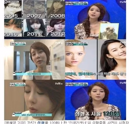 Quá trình phẫu thuật thẩm mỹ của cô gái trẻ này bắt đầu từ năm 2005 - 2012 để có được dung mạo như ngày hôm nay.