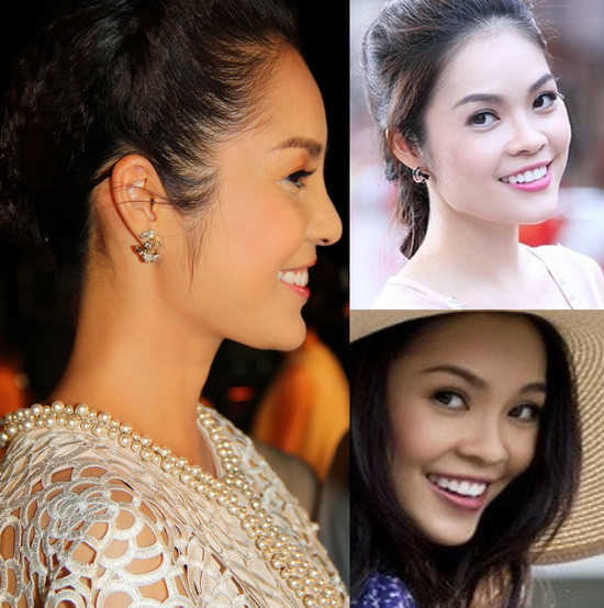 Phần sóng mũi hiện tại của Dương Cẩm Lynh cao vút trông thấy và không còn bị gãy cong như trước đây. Xem thêm: Những chiếc cằm mới của Sao Việt/ Bí quyết trang điểm xinh. Phần sóng mũi hiện tại của Dương Cẩm Lynh cao vút trông thấy và không còn bị gãy cong như trước đây. Xem thêm: Những chiếc cằm mới của Sao Việt/ Bí quyết trang điểm xinh.