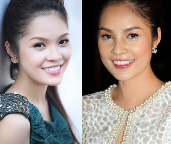 Khi được hỏi có hay không chuyện sử dụng "dao kéo", Dương Cẩm Lynh chỉ cười. Là người đẹp kín tiếng nên lần này, Dương Cẩm Lynh cũng chẳng phủ nhận hay khẳng định nghi án phẫu thuật thẩm mỹ. Người đẹp chỉ chia sẻ rằng, với cô chuyện "dao kéo" là rất bình thường với xã hội hiện tại, và nếu "dao kéo" để khiến người phụ nữ đẹp hơn thì không có lý do gì để cô nghĩ rằng nó xấu. Xem thêm: Những chiếc cằm mới của Sao Việt/ Bí quyết trang điểm xinh. Khi được hỏi có hay không chuyện sử dụng "dao kéo", Dương Cẩm Lynh chỉ cười. Là người đẹp kín tiếng nên lần này, Dương Cẩm Lynh cũng chẳng phủ nhận hay khẳng định nghi án phẫu thuật thẩm mỹ. Người đẹp chỉ chia sẻ rằng, với cô chuyện "dao kéo" là rất bình thường với xã hội hiện tại, và nếu "dao kéo" để khiến người phụ nữ đẹp hơn thì không có lý do gì để cô nghĩ rằng nó xấu. Xem thêm: Những chiếc cằm mới của Sao Việt/ Bí quyết trang điểm xinh.