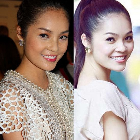 Sự thay đổi đẹp lên trông thấy này có thể nhờ sự giúp đỡ của "dao kéo". Xem thêm: Những chiếc cằm mới của Sao Việt/ Bí quyết trang điểm xinh. Sự thay đổi đẹp lên trông thấy này có thể nhờ sự giúp đỡ của "dao kéo". Xem thêm: Những chiếc cằm mới của Sao Việt/ Bí quyết trang điểm xinh.