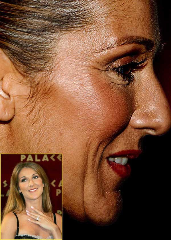 Celin Dion đang chịu sự hành hạ của quá trình lão hóa. (Ảnh: Xz) Xem thêm: Điểm danh những chiếc cằm mới của Sao Việt / Bộ sưu tập váy xinh chào hè 2012.