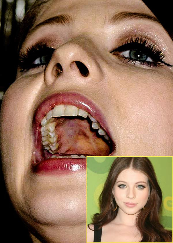Chân dung cận cảnh của Michelle Trachtenberg. Trông khác xa so với hình ảnh bóng bẩy, mỹ miều thường thấy. (Ảnh: Xz) Xem thêm: Điểm danh những chiếc cằm mới của Sao Việt / Bộ sưu tập váy xinh chào hè 2012.