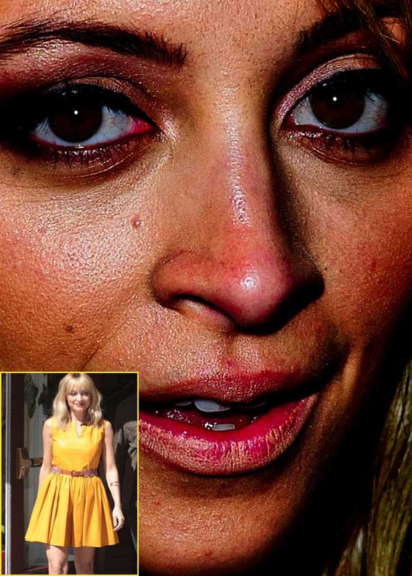 Nicole Richie chắc chắn không bao giờ muốn nhìn lại hình ảnh này của mình. (Ảnh: Xz) Xem thêm: Điểm danh những chiếc cằm mới của Sao Việt / Bộ sưu tập váy xinh chào hè 2012.