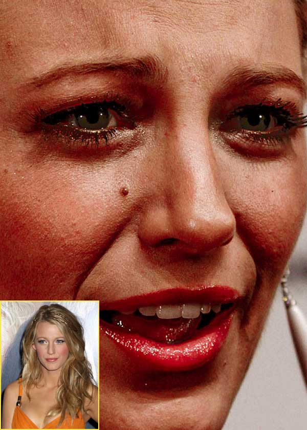 Blake Lively với phần mắt trũng sâu, thâm quầng. (Ảnh: Xz) Xem thêm: Điểm danh những chiếc cằm mới của Sao Việt / Bộ sưu tập váy xinh chào hè 2012.