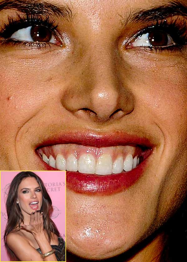 Thiên thần Victoria's Secret Alessandra Ambrosio là người đẹp hiếm hoi không khiến fan phải "đau tim" từ góc nhìn cận. (Ảnh: Xz) Xem thêm: Điểm danh những chiếc cằm mới của Sao Việt / Bộ sưu tập váy xinh chào hè 2012.