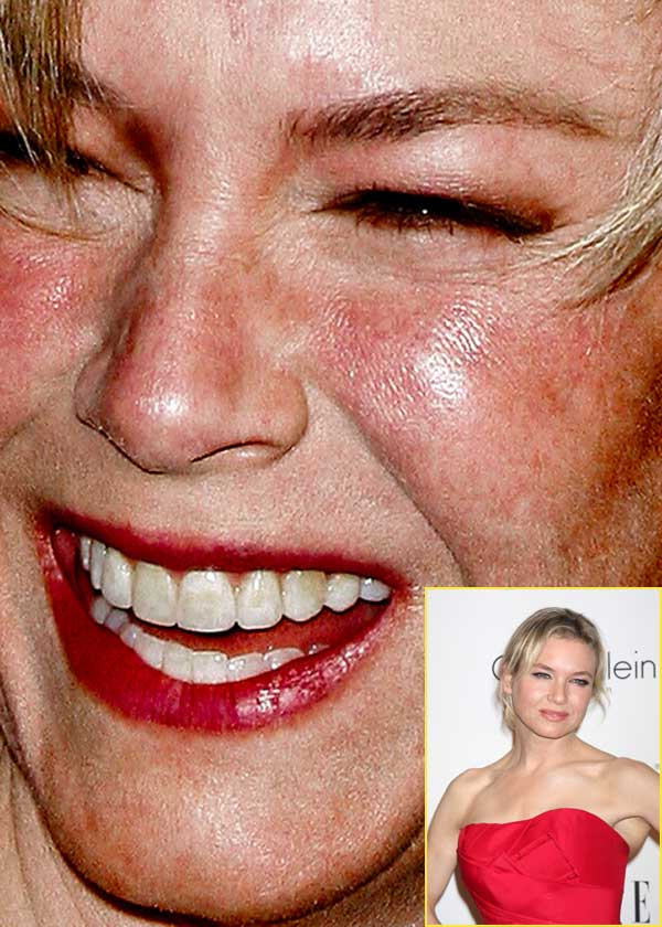 Renee Zellweger giống một bà nội trợ vui vẻ hơn là một ngôi sao. (Ảnh: Xz) Xem thêm: Điểm danh những chiếc cằm mới của Sao Việt / Bộ sưu tập váy xinh chào hè 2012.