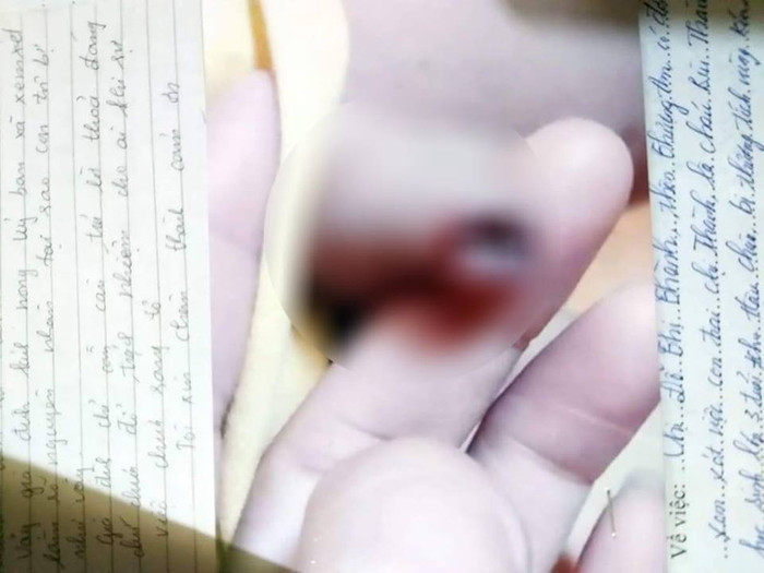 Chị Thành cho rằng con mình bị thương ở vùng kín khi được trông coi tại Trường Mầm non Liên Am (Ảnh gia đình cung cấp) Chị Thành cho rằng con mình bị thương ở vùng kín khi được trông coi tại Trường Mầm non Liên Am (Ảnh gia đình cung cấp)