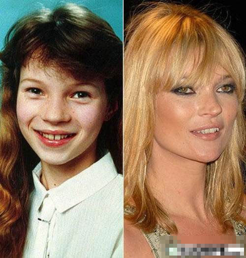 Khi trở thành siêu mẫu, Kate Moss đã đánh mất hoàn toàn nét ngọt ngào, tươi tắn đã từng có.
