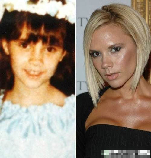 Victoria Beckham từng tự hào với thiên hạ rằng, cô sở hữu gương mặt thanh tú, chiếc cằm nhọn xinh xắn. Tuy nhiên, nhìn vào bức hình thời ấu thơ, dường như "tuyệt phẩm" đó của Vic không hoàn toàn là tự nhiên.