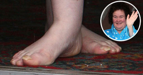 Có vẻ như ngoài giọng hát tuyệt vời ra, Susan không có chút tự hào nào về ngoại hình của mình. Thân hình mũm mĩm "đậu" trên đôi bàn chân không thể to, thô và ... nông dân hơn. (Ảnh:xz) Xem thêm: Thời trang sao Việt/ Nghệ thuật chăm sóc da ngày hè.