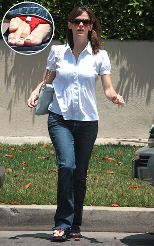 Nữ ngôi sao "Bí danh"" sở hữu đôi bàn chân... như bị dị tật. (Ảnh:xz) Xem thêm: Thời trang sao Việt/ Nghệ thuật chăm sóc da ngày hè.