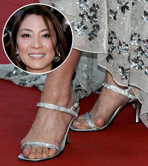 Sao nữ số 1 Trung Quốc để lộ đôi bàn chân với những u bướu, vẹo vọ. (Ảnh:xz) Xem thêm: Thời trang sao Việt/ Nghệ thuật chăm sóc da ngày hè.