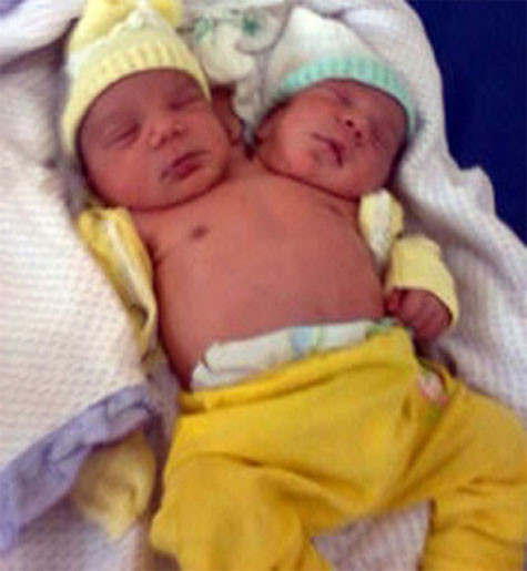 Và đây là những đứa trẻ thừa đầu. Và đây là những đứa trẻ thừa đầu.