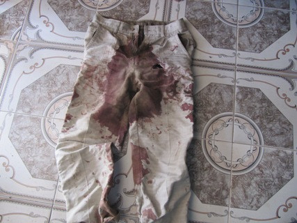 Chiếc quần đãm máu của anh Thông sau khi bị Nghĩa đâm vào vùng kín