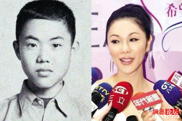 Nữ diễn viên, ca sĩ kiêm MC nổi tiếng xứ Đài Lợi Tinh từng được gia đình cho phẫu thuật chuyển đổi giới tính khi cô mới bước vào tuổi vị thành niên. Theo lời bác sĩ Trương Khởi Trung ở Đài Trung từng chia sẻ trên báo chí thì 29 năm trước có một gia đình dẫn một nam thanh niên trẻ tuổi đến yêu cầu ông phẫu thuật chuyển đổi giới tính cho con trai mình. Nữ diễn viên, ca sĩ kiêm MC nổi tiếng xứ Đài Lợi Tinh từng được gia đình cho phẫu thuật chuyển đổi giới tính khi cô mới bước vào tuổi vị thành niên. Theo lời bác sĩ Trương Khởi Trung ở Đài Trung từng chia sẻ trên báo chí thì 29 năm trước có một gia đình dẫn một nam thanh niên trẻ tuổi đến yêu cầu ông phẫu thuật chuyển đổi giới tính cho con trai mình.