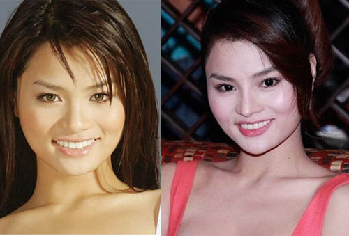 Có thể dễ dàng nhận thấy mũi của Vũ Thu Phương đã thon gọn và cao hơn nhiều. Xem thêm: Sao chuộng phẫu thuật thẩm mỹ / 10 phút trang điểm hóa mỹ nhân. Có thể dễ dàng nhận thấy mũi của Vũ Thu Phương đã thon gọn và cao hơn nhiều. Xem thêm: Sao chuộng phẫu thuật thẩm mỹ / 10 phút trang điểm hóa mỹ nhân.