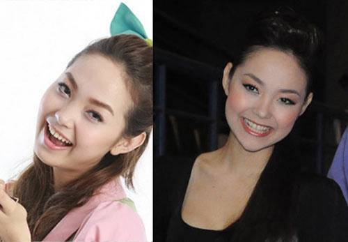 Tiếp sau nữa, chiếc cằm của người đẹp cũng có sự thay đổi. Nhiều tờ báo còn phân tích tỷ lệ khuôn mặt để minh chứng cho việc Minh Hằng đã đi độn cằm. Xem thêm: Sao chuộng phẫu thuật thẩm mỹ / 10 phút trang điểm hóa mỹ nhân. Tiếp sau nữa, chiếc cằm của người đẹp cũng có sự thay đổi. Nhiều tờ báo còn phân tích tỷ lệ khuôn mặt để minh chứng cho việc Minh Hằng đã đi độn cằm. Xem thêm: Sao chuộng phẫu thuật thẩm mỹ / 10 phút trang điểm hóa mỹ nhân.