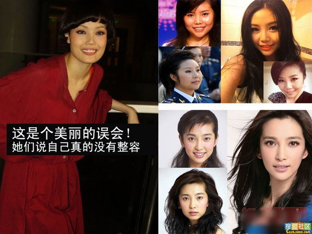 Những khuôn mặt đã biến hóa theo năm tháng nhờ thẩm mỹ hay tự nhiên?