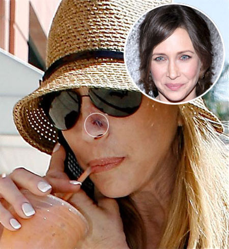 Ngôi sao Up in the Air, Vera Farmiga cũng bị nghi nâng mũi khi cô bị bắt gặp rời khỏi phòng khám của một bác sĩ ở Beverly Hills với một vết thâm tím. Tuy nhiên, nữ diễn viên đã khăng khăng vết tím đó là do cô va đập trên phim trường. Xem thêm: Bằng chứng tố Angela Baby cậy nhờ dao kéo để xinh đẹp. Ngôi sao Up in the Air, Vera Farmiga cũng bị nghi nâng mũi khi cô bị bắt gặp rời khỏi phòng khám của một bác sĩ ở Beverly Hills với một vết thâm tím. Tuy nhiên, nữ diễn viên đã khăng khăng vết tím đó là do cô va đập trên phim trường. Xem thêm: Bằng chứng tố Angela Baby cậy nhờ dao kéo để xinh đẹp.