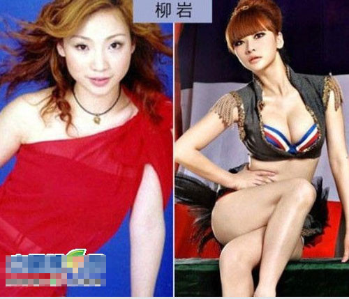 Xuất phát điểm là một cô gái nhan sắc thường thường bậc trung, Liễu Nham nhanh chóng ghi tên tuổi với ngoại hình dao kéo tuyệt đẹp. Xem thêm: Tuyệt chiêu giảm béo, giữ gìn dáng ngọc của 9 kiều nữ Hàn Xuất phát điểm là một cô gái nhan sắc thường thường bậc trung, Liễu Nham nhanh chóng ghi tên tuổi với ngoại hình dao kéo tuyệt đẹp. Xem thêm: Tuyệt chiêu giảm béo, giữ gìn dáng ngọc của 9 kiều nữ Hàn