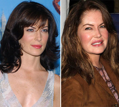 Nhìn Lara Flynn Boyle năm 2002 và năm 2010 như hai người khác nhau chỉ bởi vì đôi môi bơm silicon. Xem thêm: Sao xấu - Sao đẹp/ Thời trang sao Nhìn Lara Flynn Boyle năm 2002 và năm 2010 như hai người khác nhau chỉ bởi vì đôi môi bơm silicon. Xem thêm: Sao xấu - Sao đẹp/ Thời trang sao