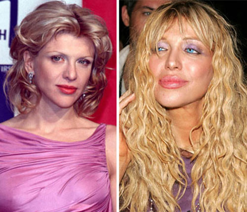 Rocker Courtney Love cũng bật mí cô đã nhờ tới thẩm mỹ viện để bơm môi. Nhìn hình ảnh cô năm 1997 và 10 năm sau thấy rõ sự thay đổi này. Xem thêm: Sao xấu - Sao đẹp/ Thời trang sao Rocker Courtney Love cũng bật mí cô đã nhờ tới thẩm mỹ viện để bơm môi. Nhìn hình ảnh cô năm 1997 và 10 năm sau thấy rõ sự thay đổi này. Xem thêm: Sao xấu - Sao đẹp/ Thời trang sao
