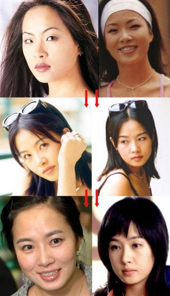 Kim Seon Ah khiến hàng triệu phụ nữ tuổi 30 phải ghen tỵ vì vẻ đẹp quá đỗi ngọt ngào, hiền dịu nhờ... phẫu thuật thẩm mỹ. (Ảnh: tienphong) Xem thên: Sao và những cuộc trùng tu nhan sắc/ Nghệ thuật chăm sóc da tươi sáng, mịn màng. Kim Seon Ah khiến hàng triệu phụ nữ tuổi 30 phải ghen tỵ vì vẻ đẹp quá đỗi ngọt ngào, hiền dịu nhờ... phẫu thuật thẩm mỹ. (Ảnh: tienphong) Xem thên: Sao và những cuộc trùng tu nhan sắc/ Nghệ thuật chăm sóc da tươi sáng, mịn màng.