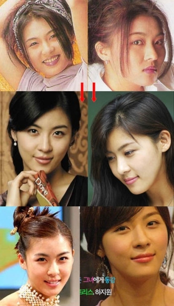 Ha Ji Won có lẽ đã trải qua vài ba cuộc đại phẫu mới có được nhan sắc yêu kiều như ngày nay. (Ảnh: tienphong) Xem thên: Sao và những cuộc trùng tu nhan sắc/ Nghệ thuật chăm sóc da tươi sáng, mịn màng. Ha Ji Won có lẽ đã trải qua vài ba cuộc đại phẫu mới có được nhan sắc yêu kiều như ngày nay. (Ảnh: tienphong) Xem thên: Sao và những cuộc trùng tu nhan sắc/ Nghệ thuật chăm sóc da tươi sáng, mịn màng.