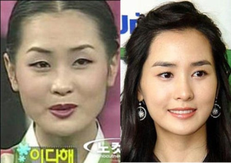 Lee Da Hee là nữ nghệ sĩ hiếm hoi dám công khai thừa nhận "Tôi đã phẫu thuật thẩm mỹ". (Ảnh: tienphong) Xem thên: Sao và những cuộc trùng tu nhan sắc/ Nghệ thuật chăm sóc da tươi sáng, mịn màng. Lee Da Hee là nữ nghệ sĩ hiếm hoi dám công khai thừa nhận "Tôi đã phẫu thuật thẩm mỹ". (Ảnh: tienphong) Xem thên: Sao và những cuộc trùng tu nhan sắc/ Nghệ thuật chăm sóc da tươi sáng, mịn màng.
