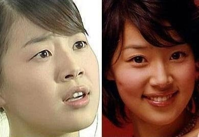 Han Jin Hye chỉnh sửa mắt một mí thành hai mí rất đẹp. (Ảnh: tienphong) Xem thên: Sao và những cuộc trùng tu nhan sắc/ Nghệ thuật chăm sóc da tươi sáng, mịn màng. Han Jin Hye chỉnh sửa mắt một mí thành hai mí rất đẹp. (Ảnh: tienphong) Xem thên: Sao và những cuộc trùng tu nhan sắc/ Nghệ thuật chăm sóc da tươi sáng, mịn màng.