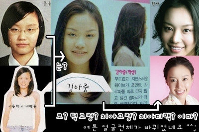 Kim Ah Jung đẹp lên trông thấy, đặc biệt là chiếc mũi cao xinh xắn và khuôn mặt thanh tú. (Ảnh: tienphong) Xem thên: Sao và những cuộc trùng tu nhan sắc/ Nghệ thuật chăm sóc da tươi sáng, mịn màng. Kim Ah Jung đẹp lên trông thấy, đặc biệt là chiếc mũi cao xinh xắn và khuôn mặt thanh tú. (Ảnh: tienphong) Xem thên: Sao và những cuộc trùng tu nhan sắc/ Nghệ thuật chăm sóc da tươi sáng, mịn màng.