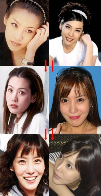 Kim Jung Eun chắc chắn đã chỉnh sửa mũi và cằm. (Ảnh: tienphong) Xem thên: Sao và những cuộc trùng tu nhan sắc/ Nghệ thuật chăm sóc da tươi sáng, mịn màng. Kim Jung Eun chắc chắn đã chỉnh sửa mũi và cằm. (Ảnh: tienphong) Xem thên: Sao và những cuộc trùng tu nhan sắc/ Nghệ thuật chăm sóc da tươi sáng, mịn màng.