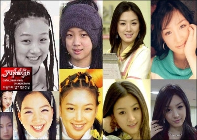 Jeong Ryeo Won có màn lột xác ngoạn mục. Sau khi phẫu thuật, trông cô xinh đẹp và quyến rũ như một nữ thần Kbiz. (Ảnh: tienphong) Xem thên: Sao và những cuộc trùng tu nhan sắc/ Nghệ thuật chăm sóc da tươi sáng, mịn màng. Jeong Ryeo Won có màn lột xác ngoạn mục. Sau khi phẫu thuật, trông cô xinh đẹp và quyến rũ như một nữ thần Kbiz. (Ảnh: tienphong) Xem thên: Sao và những cuộc trùng tu nhan sắc/ Nghệ thuật chăm sóc da tươi sáng, mịn màng.