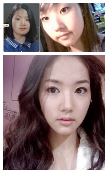Park Min Young là sự thành công ngoài sức mong đợi của các bác sĩ. Cô quá đỗi xinh đẹp, cuốn hút với diện mạo hiện tại. (Ảnh: tienphong) Xem thên: Sao và những cuộc trùng tu nhan sắc/ Nghệ thuật chăm sóc da tươi sáng, mịn màng. Park Min Young là sự thành công ngoài sức mong đợi của các bác sĩ. Cô quá đỗi xinh đẹp, cuốn hút với diện mạo hiện tại. (Ảnh: tienphong) Xem thên: Sao và những cuộc trùng tu nhan sắc/ Nghệ thuật chăm sóc da tươi sáng, mịn màng.