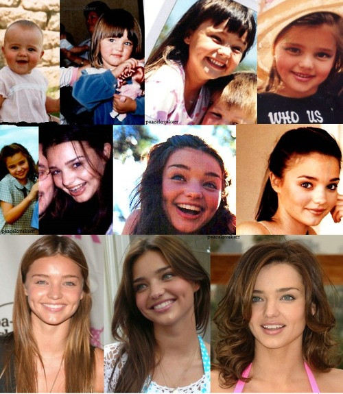 Không biết "tiểu thiên nga nước Úc" có cậy nhờ đến dao kéo hay không, nhưng không thể phủ nhận nhan sắc cô nàng ngày càng xinh đẹp, cuốn hút theo thời gian. (Ảnh: ngoisao) Xem thêm: Vẻ đẹp thiên thần của mỹ nhân facebook Việt/ Thời trang hè 2012. Không biết "tiểu thiên nga nước Úc" có cậy nhờ đến dao kéo hay không, nhưng không thể phủ nhận nhan sắc cô nàng ngày càng xinh đẹp, cuốn hút theo thời gian. (Ảnh: ngoisao) Xem thêm: Vẻ đẹp thiên thần của mỹ nhân facebook Việt/ Thời trang hè 2012.