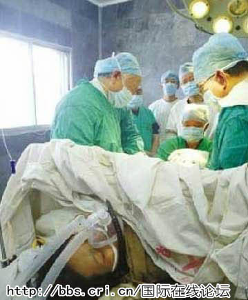 Trong quá trình mổ. Trong quá trình mổ.