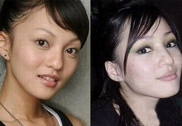 Trương Thiếu Hiên và Trương Thiếu Hàm – hai chị em họ trông giống nhau như đúc và đẹp như người mẫu vậy, không thành sao mới thật là phí. Trước khi gia nhập làng giải trí, gia đình Trương Thiếu Hàm từng sống ở Canada, hai chị em họ vẫn thường cùng nhau tham gia các cuộc thi hát, hai chị em họ thật đúng là ngang ngửa nhau về cả tài nghệ, sắc đẹp xuất chúng và dần được cộng đồng người Hoa ở nước ngoài đón nhận. Về sau cô chị Trương Thiếu Hàm theo m ẹ về Đài Loan phát triển sự nghiệp ca hát trong khi cô em Trương Thiếu Hiên ở lại tiếp tục công việc học hành. Trong một lần, khi Trương Thiếu Hiên tham gia một sự kiện thời trang và những bức hình của cô được đăng trên mạng thì mọi người mới nhận ra tài năng thực sự của cô em này. Thế nhưng, tuy xinh đẹp không hề thua kém cô chị nhưng Trương Thiếu Hiên thấy thoải mái hơn khi đứng phía sau hậu trường ngành công nghiệp giải trí. Angela Trương Thiếu Hàm cho hay cô mong rằng em gái mình một ngày không xa sẽ có được hình tượng của riêng cô.