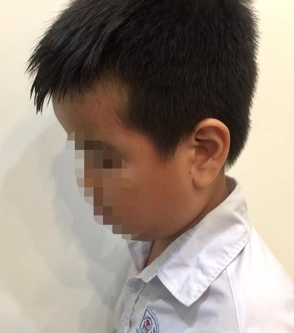 Gia đình em Đ. phản ánh con mình bị cô Trang đánh vào mặt trong giờ kiểm tra (Ảnh: Gia đình cung cấp) Gia đình em Đ. phản ánh con mình bị cô Trang đánh vào mặt trong giờ kiểm tra (Ảnh: Gia đình cung cấp)