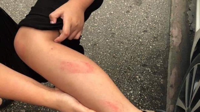 Hải Phòng kỷ luật nghiêm 2 cô giáo và Ban giám hiệu vụ đánh học sinh lớp 2 ảnh 4 Hải Phòng kỷ luật nghiêm 2 cô giáo và Ban giám hiệu vụ đánh học sinh lớp 2 ảnh 4