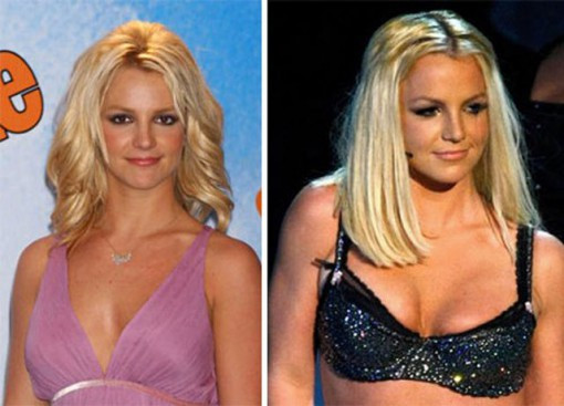 Britney Spears ngực lép (trái) và sau khi đã qua công nghệ... PTS (phải). Britney Spears ngực lép (trái) và sau khi đã qua công nghệ... PTS (phải).