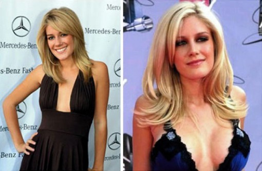 Nữ diễn viên Heidi Montag. Nữ diễn viên Heidi Montag.