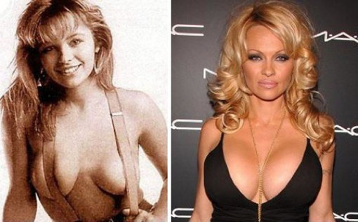 Pamela Anderson. Pamela Anderson.