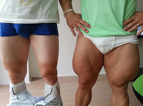 Đôi chân to bất thường và gây sốc của Andre Greipel và Robert Forstemann. Ảnh: Sun. Đôi chân to bất thường và gây sốc của Andre Greipel và Robert Forstemann. Ảnh: Sun.