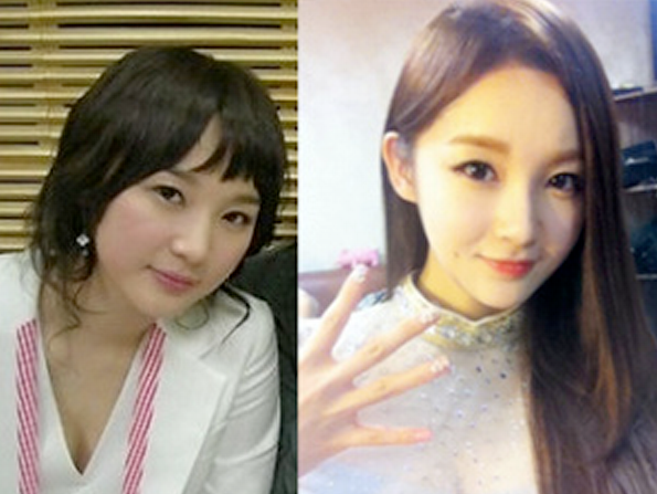 Kang Min Kyung xinh đẹp của Davichi ngày xưa cũng không đến nỗi nào, duy chỉ có điều gương mặt trước đây của Kang khi chưa được gọt thì trông tròn đầy như hình bên trái. Kang Min Kyung xinh đẹp của Davichi ngày xưa cũng không đến nỗi nào, duy chỉ có điều gương mặt trước đây của Kang khi chưa được gọt thì trông tròn đầy như hình bên trái.