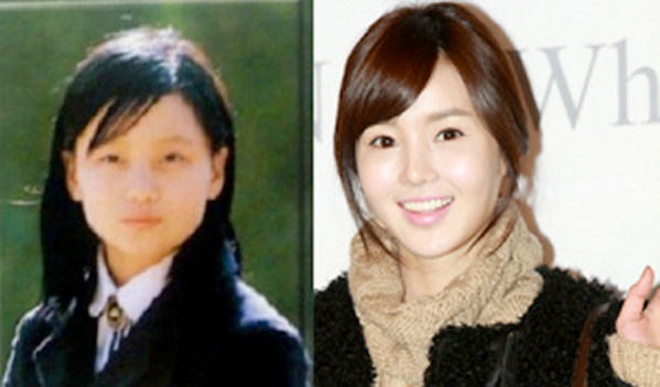 Nữ diễn viên sinh năm 1985 Nam Gyuri có lẽ đã trải qua một cuộc chỉnh sửa xương quai hàm. Nữ diễn viên sinh năm 1985 Nam Gyuri có lẽ đã trải qua một cuộc chỉnh sửa xương quai hàm.