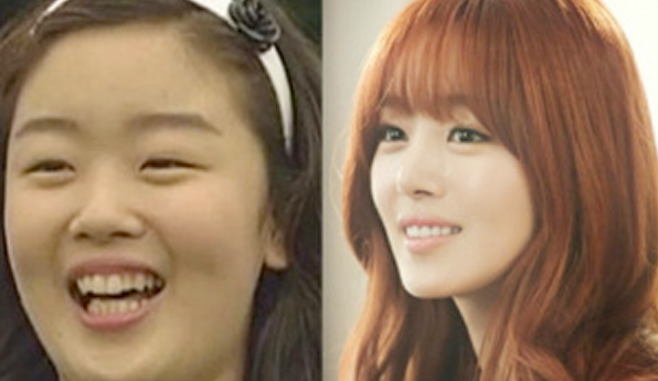 Thành viên Han Sun Hwa trong nhóm Secret sở hữu gương mặt tròn xoe, đôi mắt một mí, chiếc mũi tẹt và hàm răng nhấp nhô khi chưa thành sao. Thành viên Han Sun Hwa trong nhóm Secret sở hữu gương mặt tròn xoe, đôi mắt một mí, chiếc mũi tẹt và hàm răng nhấp nhô khi chưa thành sao.