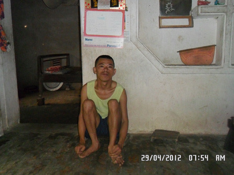 Anh Phạm Văn Hưng mang căn bệnh tâm thần bẩm sinh Anh Phạm Văn Hưng mang căn bệnh tâm thần bẩm sinh
