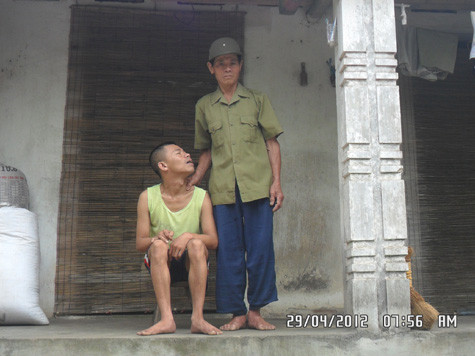 Ông Phạm Dư Uông bên người con trai ngây dại của mình. Ông Phạm Dư Uông bên người con trai ngây dại của mình.